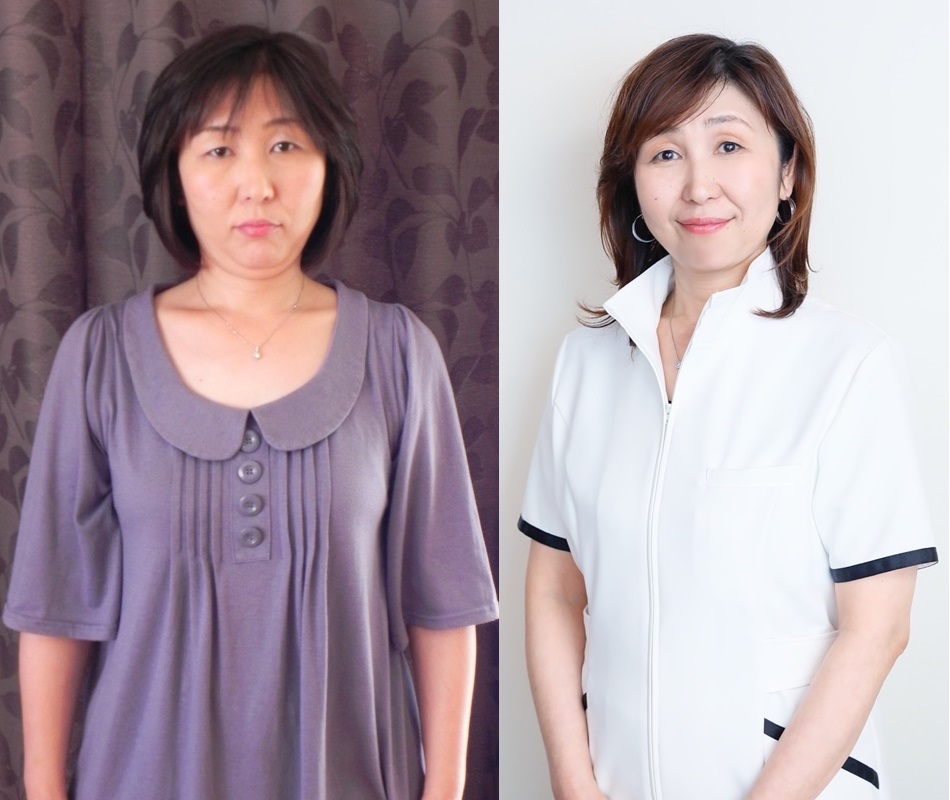 豊田市・知立市・安城市・岡崎市で瘦せるなら、ピックアップの耳ツボダイエット