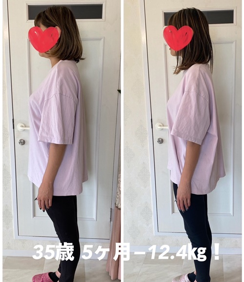 運動なしで痩せるなら、豊田市エイムの耳ツボダイエット