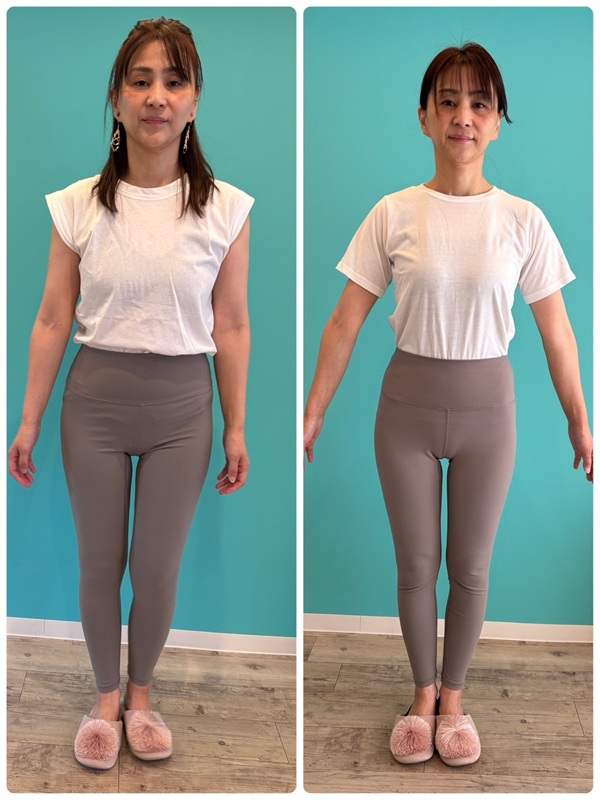 静岡県藤枝市・焼津市でダイエットするならエミリアの耳ツボダイエット