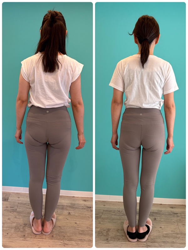 何をしても痩せない人に試してほしい耳ツボダイエット