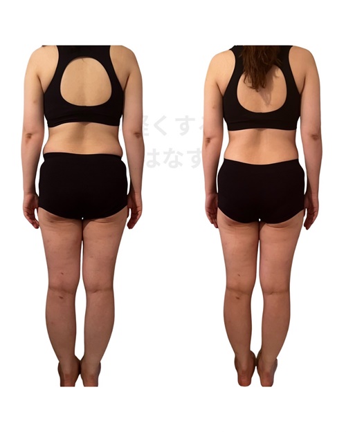 岡崎市・西尾市・安城市・幸田町でダイエットするならアサミ整体の耳ツボダイエット