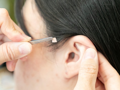 岡崎市で痩せるなら、はなすの耳ツボダイエット