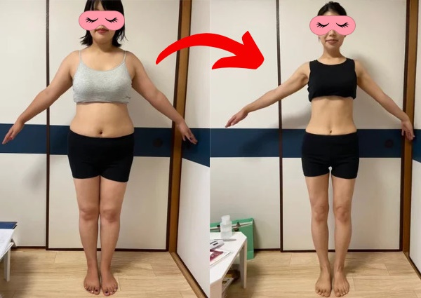 米子市で瘦せるなら、米子すりむミミの耳ツボダイエット