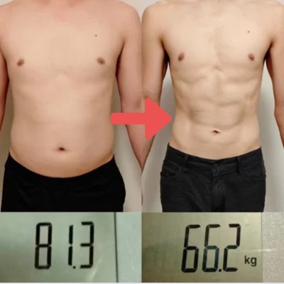 米子市で痩せるなら、米子すりむミミの耳ツボダイエット